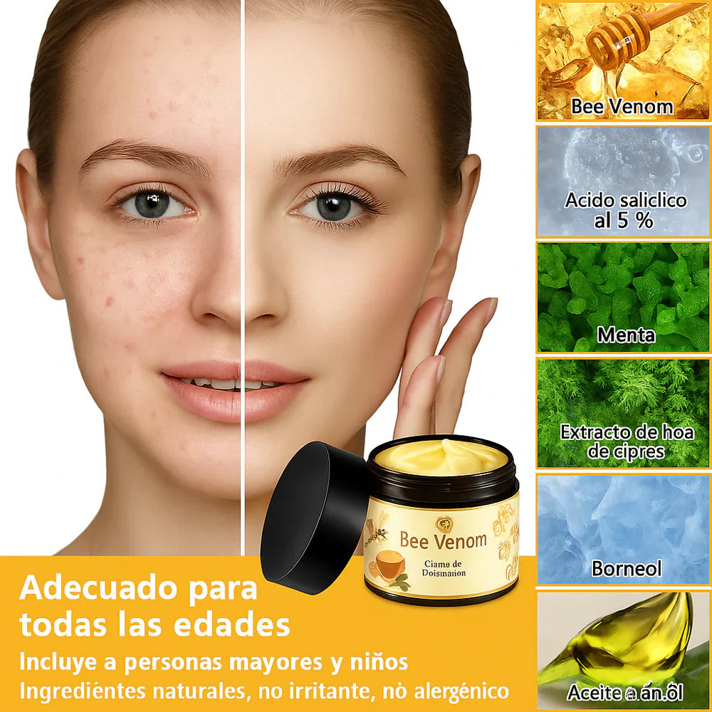 🐝 Bee Venom | Treatment Cream 🐝 (120 Gramos)