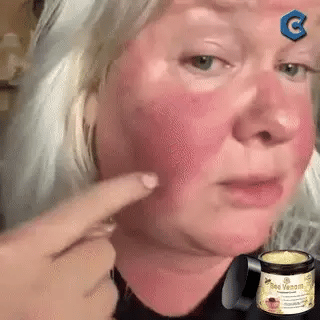 🐝 Bee Venom | Treatment Cream 🐝 (120 Gramos)