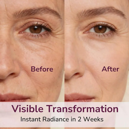 Dr. Melaxin Bálsamo Glow | Adiós Piel Seca y Ojeras